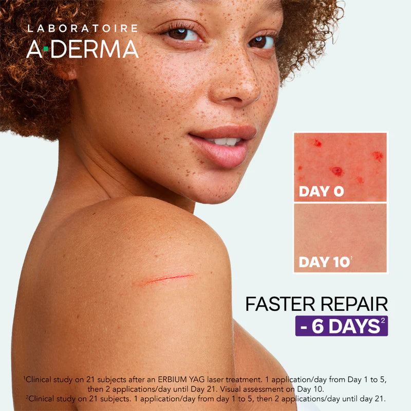 A-Derma Epitheliale A.H Ultra Anti-Mark Ultra-Repairing Cream with free A-Derma The Indispensable Hand Cream for skin repair and daily hand care.