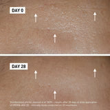 FILORGA HYDRA-AOX [5] Serum 30ml results