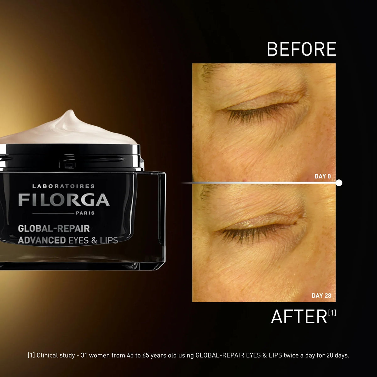 Filorga GLOBAL-REPAIR ADVANCED Eyes & Lips Before After