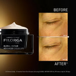 Filorga GLOBAL-REPAIR ADVANCED Eyes & Lips Before After