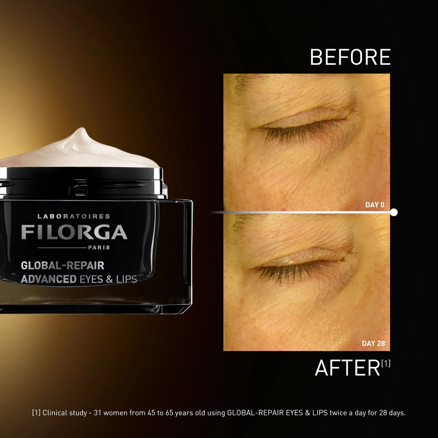 Filorga GLOBAL-REPAIR ADVANCED Eyes & Lips Before After