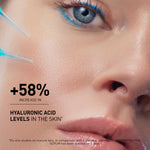 Close-up of a person's eye with text highlighting increased hyaluronic acid levels in the skin.