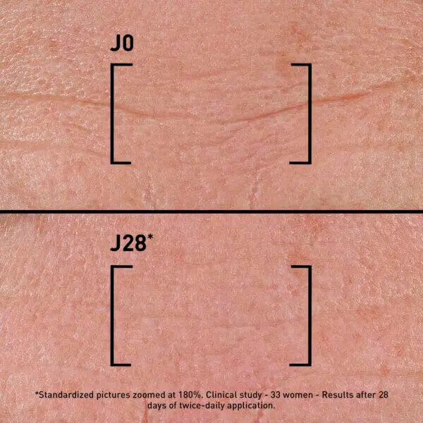 Comparison of skin texture labeled J0 and J28 with clinical study details.