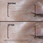 Before and after comparison of skin texture with clinical study details.