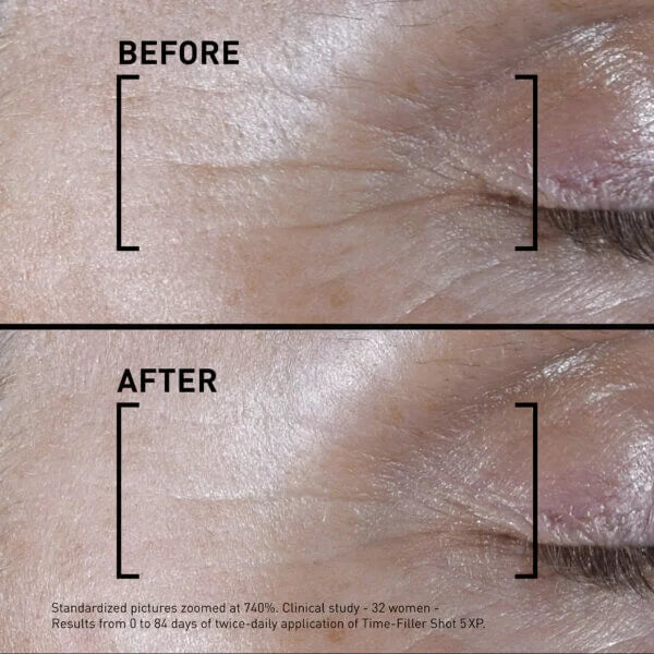 Before and after comparison of skin texture with clinical study details.
