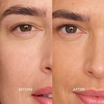Before and after comparison of a person's eye area with visible skin improvement.