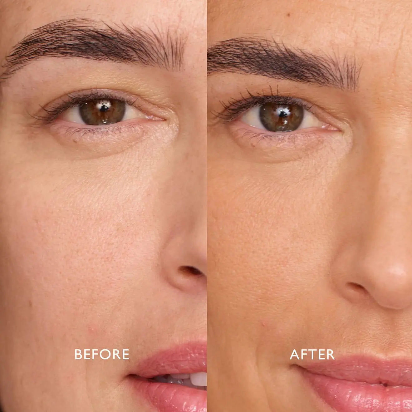 Before and after comparison of a person's eye area with visible skin improvement.