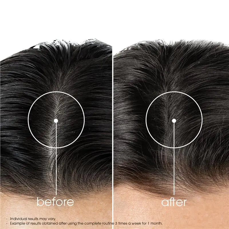 Klorane Quinine and Organic Edelweiss Strengthening Shampoo at The Distriqt Lebanon