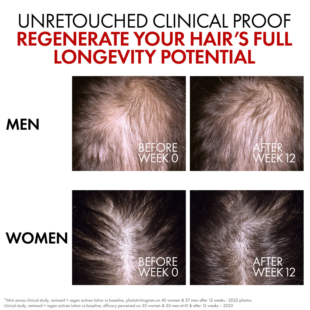 Hair renewal serum with 1.5% Aminexil that helps reduce hair loss, support hair growth, and improve hair density.