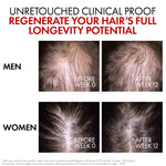 Hair renewal serum with 1.5% Aminexil that helps reduce hair loss, support hair growth, and improve hair density.