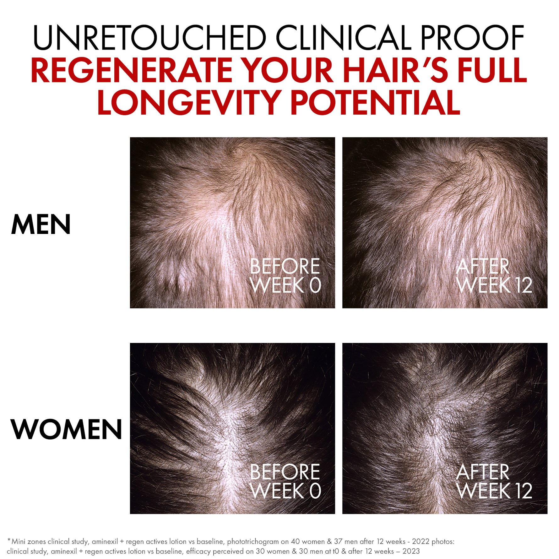 Hair renewal serum with 1.5% Aminexil that helps reduce hair loss, support hair growth, and improve hair density.