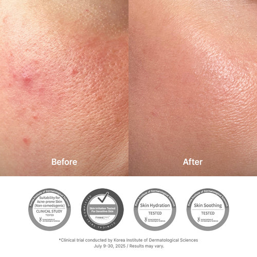 Dr.Althea 345 Relief Cream for sensitive acne-prone skin Lebanon