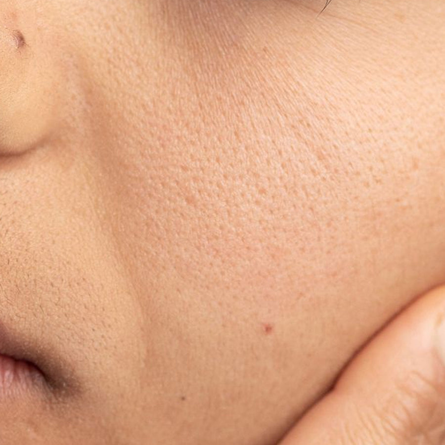 Dull Skin