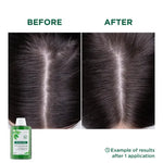 Klorane Oil Control Shampoo for oily scalp available in Lebanon at The Distriqt