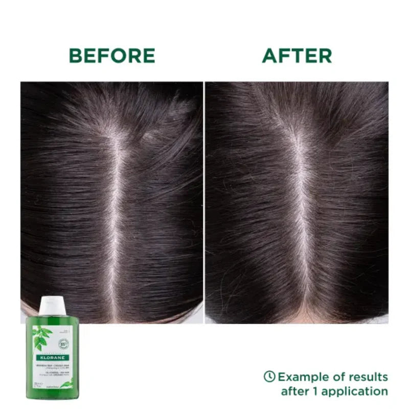 Klorane Oil Control Shampoo for oily scalp available in Lebanon at The Distriqt