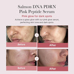 Medicube TXA Niacinamide Korean serum for uneven skin tone