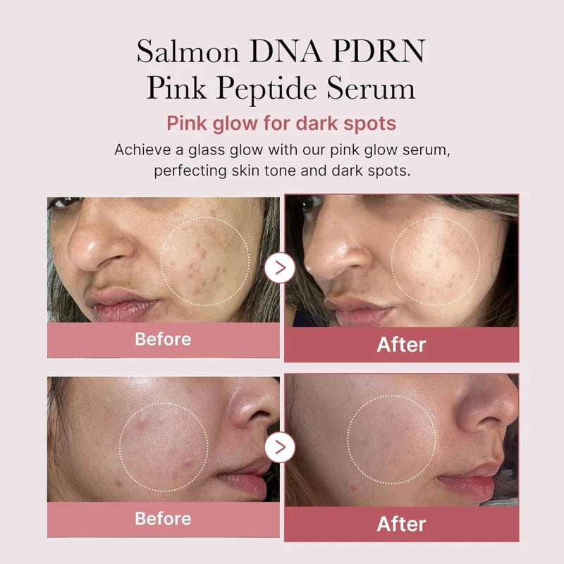 Medicube TXA Niacinamide Korean serum for uneven skin tone